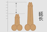 延长