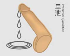 早泄