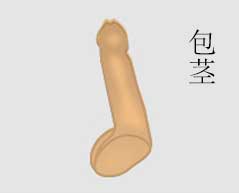 包茎