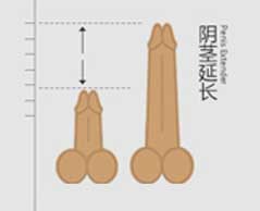延长