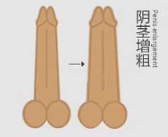 增粗