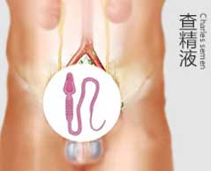 精液不液化