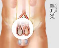 睾丸炎