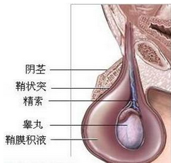 治睾丸炎要多少钱?