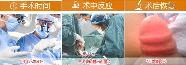 番禺割包皮