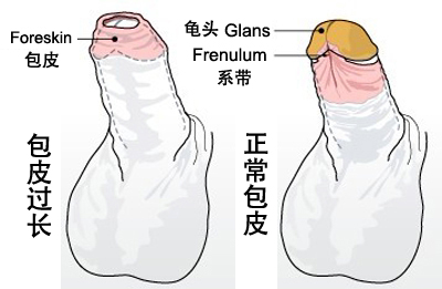 خǼҽԺƤõ