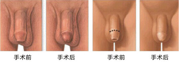 خаƤҪǮ