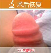 ݷخļҽԺƤи