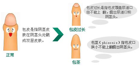 ݴǸҽԺƤõ㰡