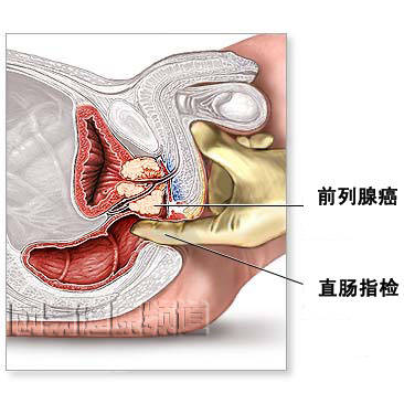 广州汉溪长隆治疗前列腺炎医院
