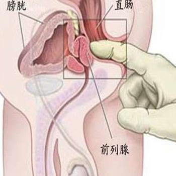 خǰ֢ҪǮ