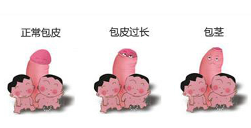 ϴаƤҪǮ
