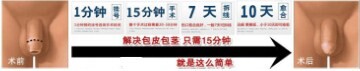 齭³ǸƤ
