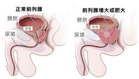 魺˿ǰҪǮ