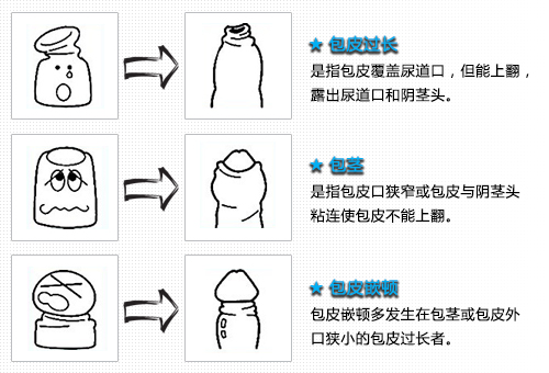 http://zhidao.baidu.com/question/755412313283877444.html