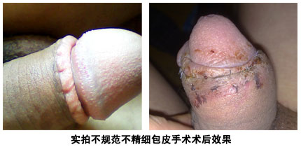 خҽԺƤǮ