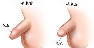 ݷخҽԺƤҪǮ