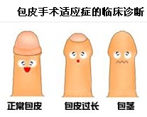 خӴƤҪסԺ